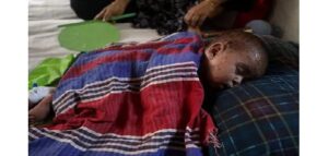Measles Vaccine at 6 Months? Health Department Issues New Guidelines for Parents!
